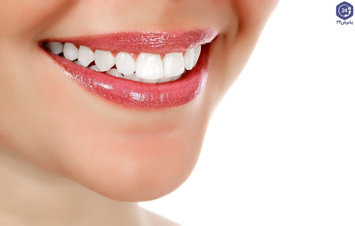 ۴ روش پزشکی و ۱۲ روش‌ خانگی سفید کردن دندان