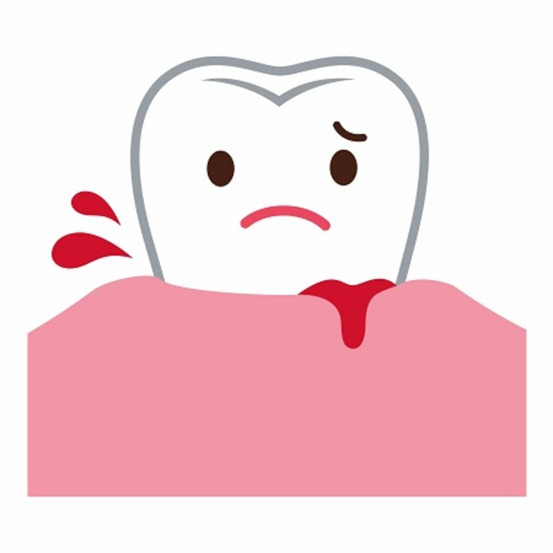 عوامل خونریزی دندان و قطع فوری آن