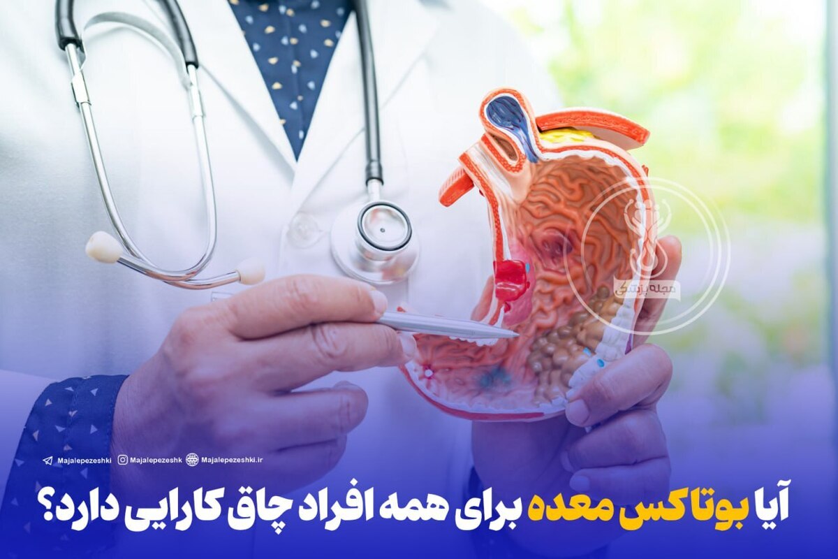 آیا بوتاکس معده برای همه افراد چاق کارایی دارد؟