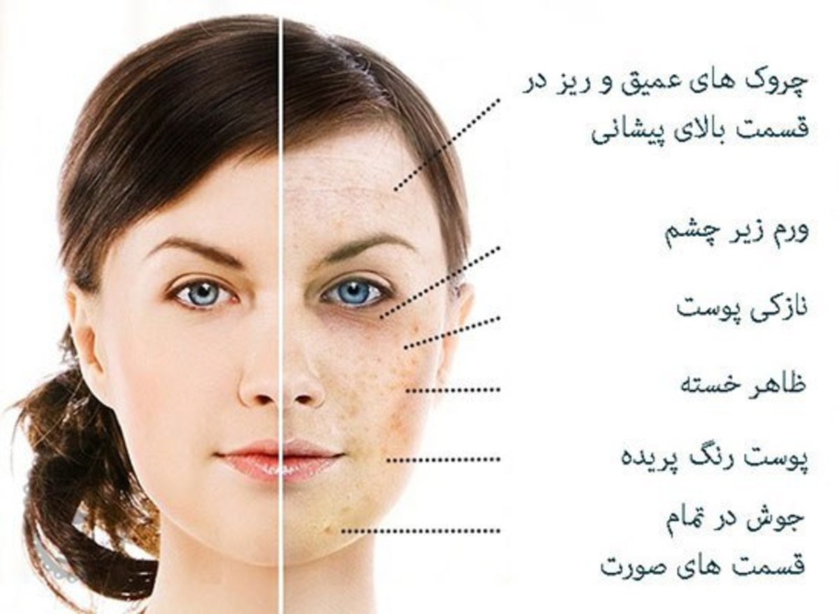 تاثیر کمبود پنج ماده غذایی بر چهره