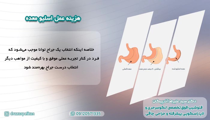 اسلیو معده: روشی پایدار برای کاهش وزن و بهبود سلامت