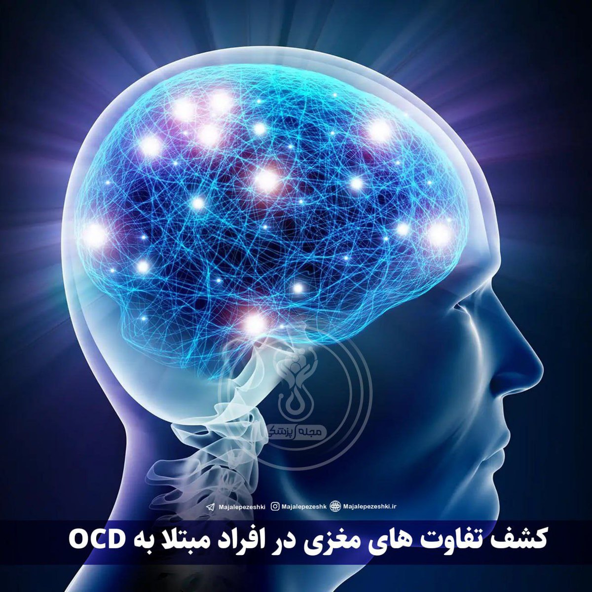 کشف تفاوت های مغزی در افراد مبتلا به OCD