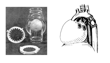 هفتاد و دومين سالروز اولين عمل جراحي تعبيه دريچه مصنوعي قلب در جهان