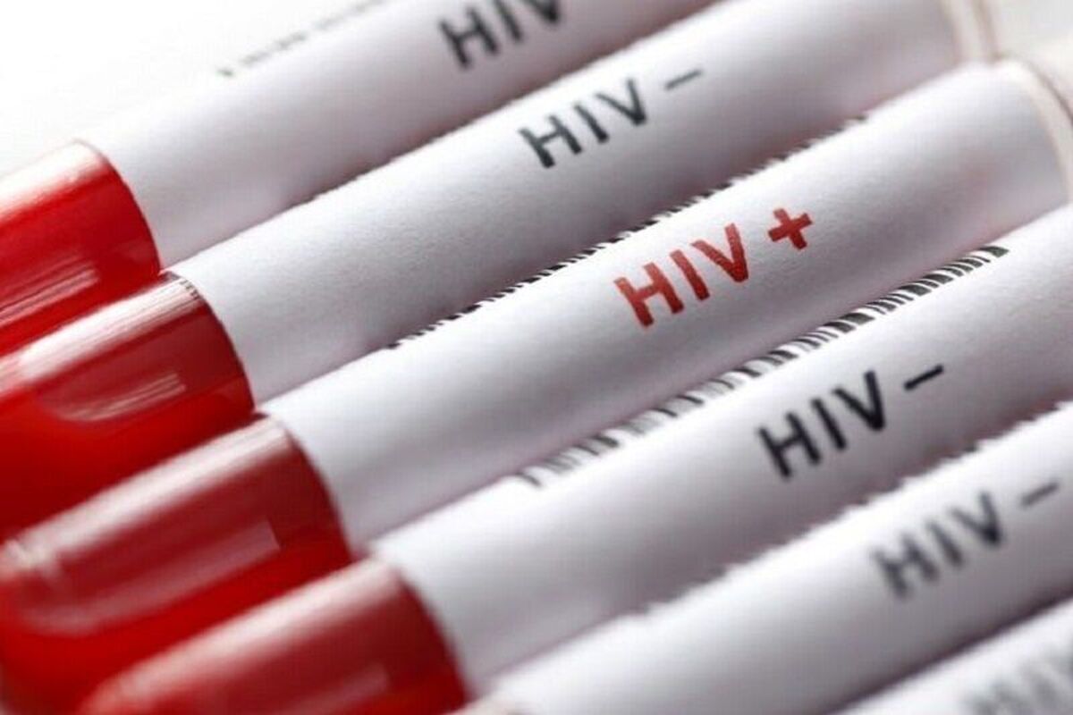 شناسایی ۲ مورد جدید مبتلا به HIV در سقز