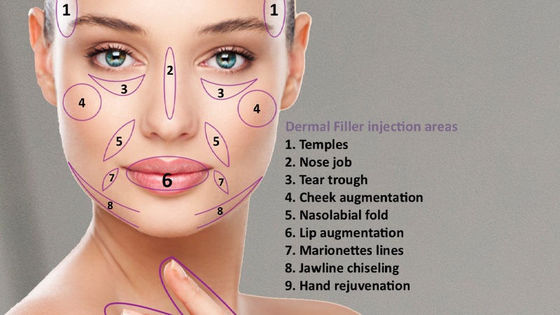 بهترین دکتر تزریق فول فیس در شیراز؛ همه آنچه باید بدانید بهترین دکتر تزریق فول فیس در شیراز؛ همه آنچه باید بدانید